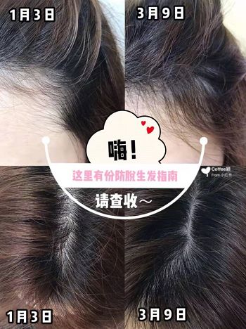 走进奇迹世界，最新生发科技的头发再生之旅🌱